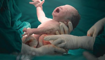 تونس: أول عملية ولادة قيصرية لمصابة بكورونا